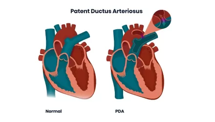 What is a PDA?