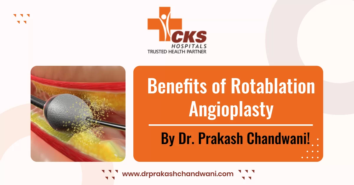 Benefits of Rotablation Angioplasty