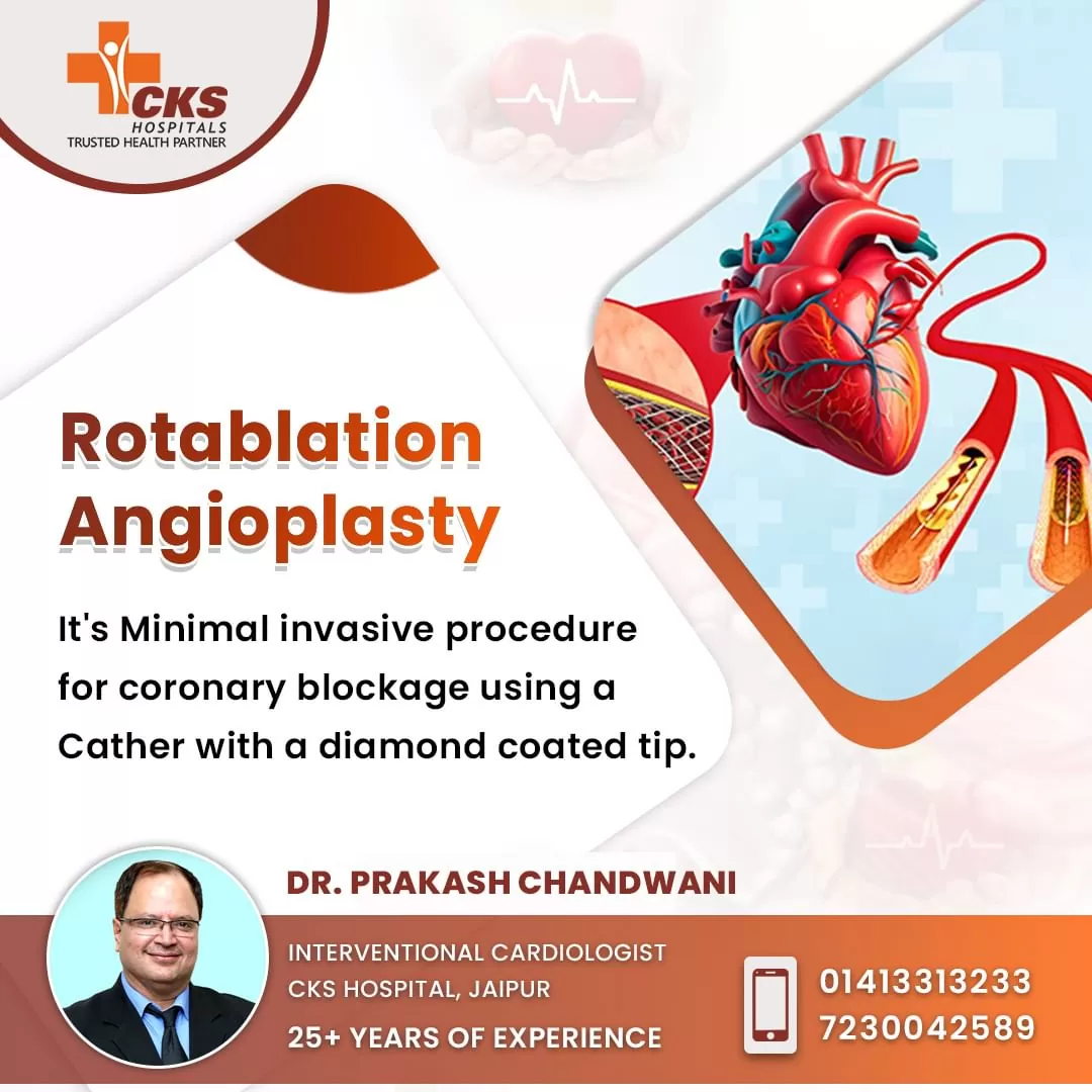 Rotablation Angioplasty By Dr. Prakash Chandwani