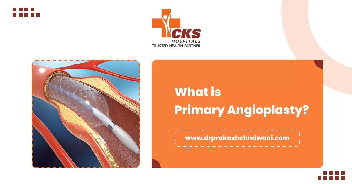 What is Primary Angioplasty?