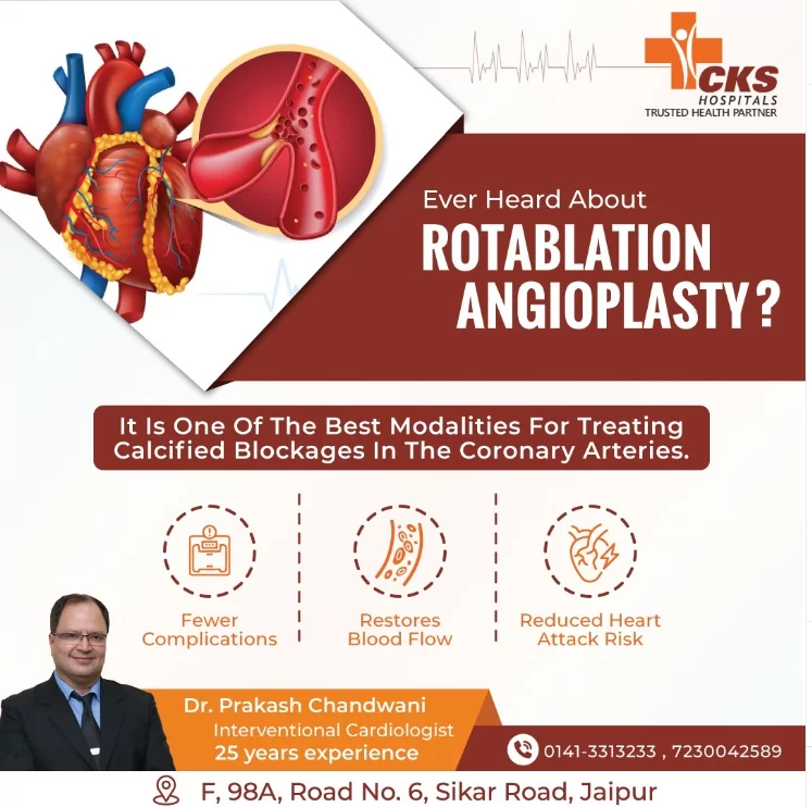 Ever Heard About Rotablation Angioplasty