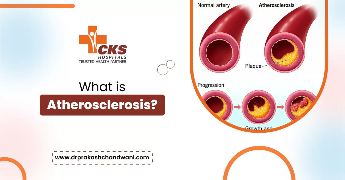 What is Atherosclerosis?