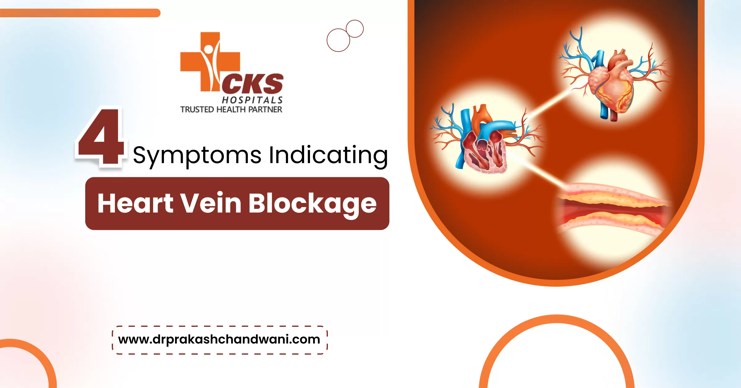 4 Symptoms Indicating Heart Vein Blockage